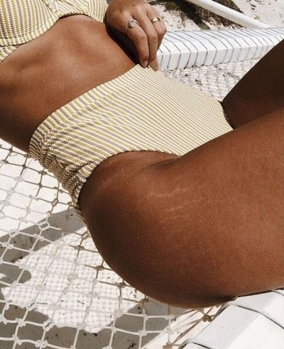 Minimize the Appearance of Cellulite