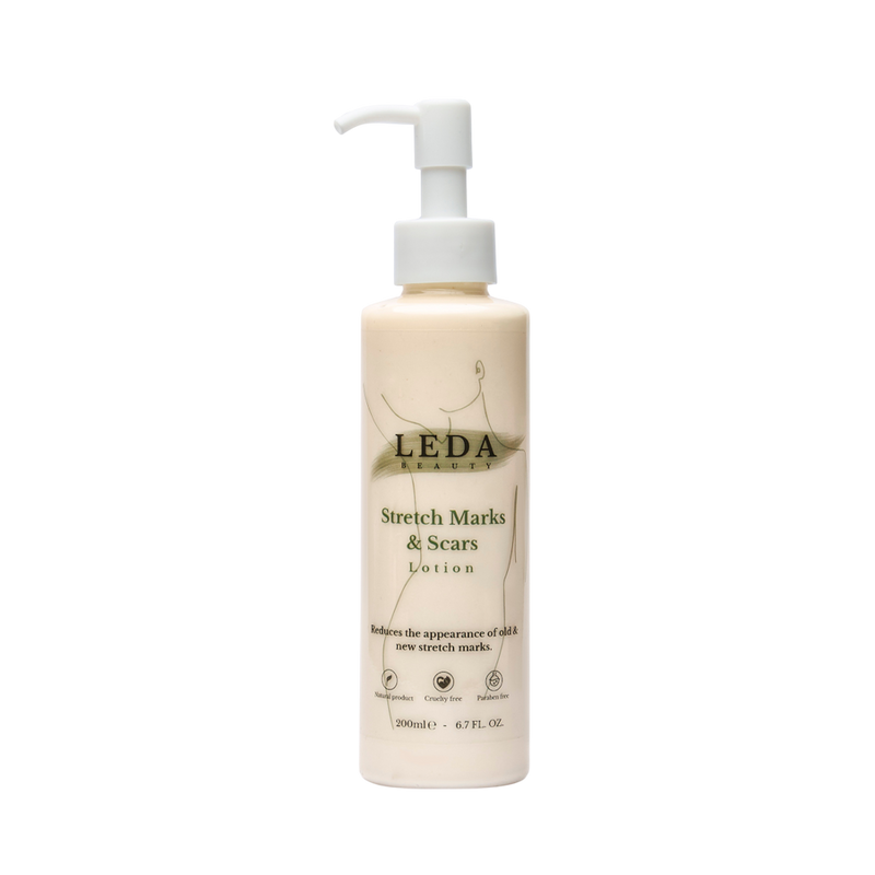 Stretch Marks Lotion
