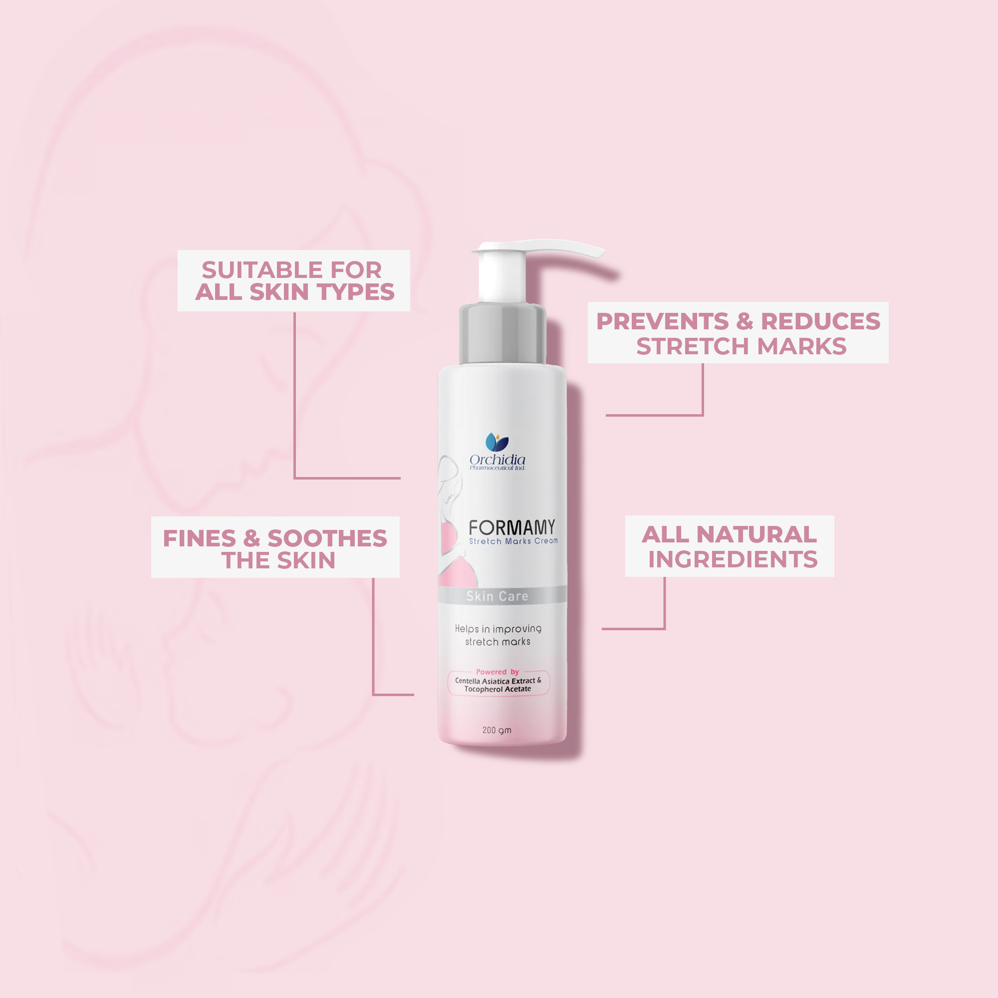 كريم لعلامات التمدد