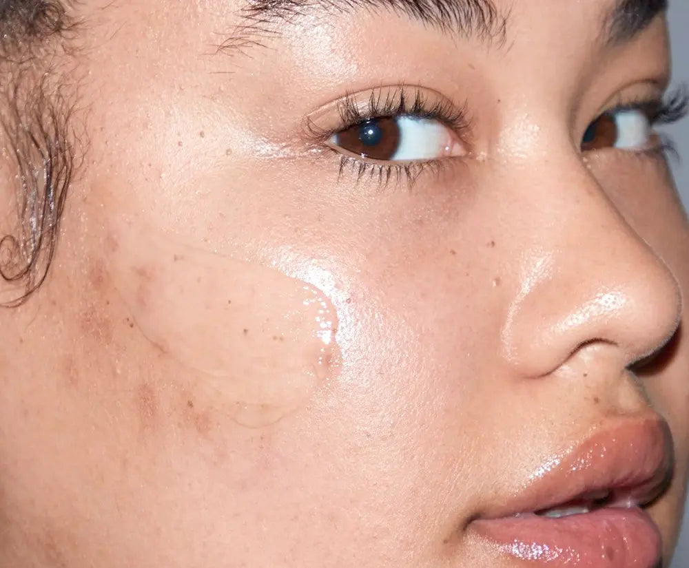 Acne & Blemishes
